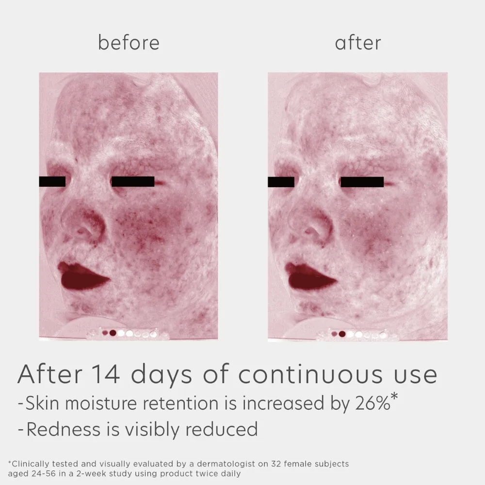 EltaMD Skin Recovery Amino Acid Foaming Cleanser